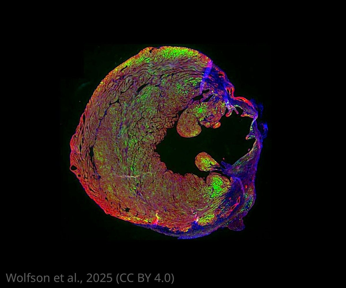 eLife's tweet image. Bioluminescent imaging tracks how viral vectors deliver regeneration-boosting DNA after heart injury, helping scientists fine-tune gene therapy to hit the right place at the right time.
elifesciences.org/articles/10794…