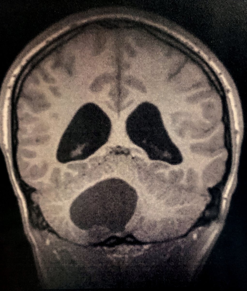CraigHorbinski's tweet image. Looks like #Ghostface from the @ScreamMovies