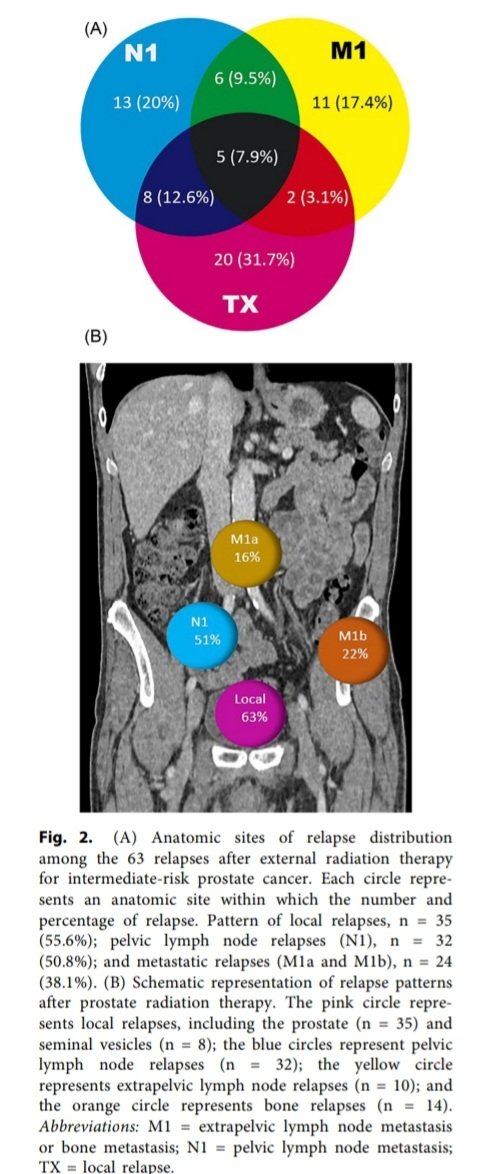 nataliagandur's tweet image. 🔵 🆕️ 2025 insights from the #PROFIT trial in #ProstateCancer
Focusing on intermediate-risk patients treated with RT:
📌 1. Patient-reported outcomes (Sanmamed et al.)
🔹️ Hypofractionation (60 Gy/20 fx) vs. Conventional (78 Gy/39 fx)
🔹️Comparable urinary QoL
🔹️ Less…