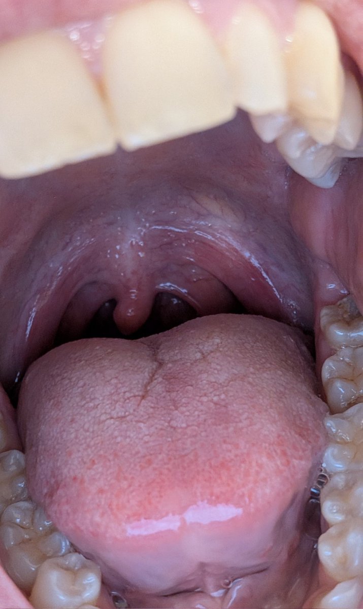 It’s funny how fascinated you tinies get with my u v u l a. Just dangling there, swaying with every breath… so close, so tempting. You really think you could reach it? Careful though go too far, and I might just swallow.