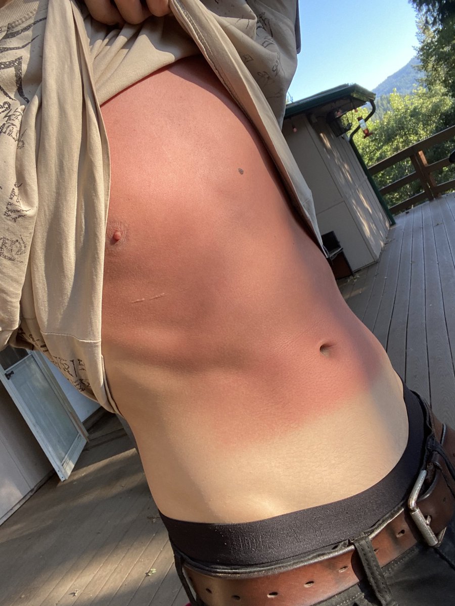 Theodore1jensen's tweet image. finally got a nice tan going 😍🙏🙏🙏
(i am in so much pain)