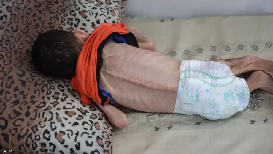 DinaAyyad4's tweet image. My children have become skeletons from severe malnutrition😭😭.
What are you waiting for, they are dying Where are the kind-hearted people? Where is humanity? Where are those who love children?
Donate for my children and save them from starvation
gofund.me/134fab53