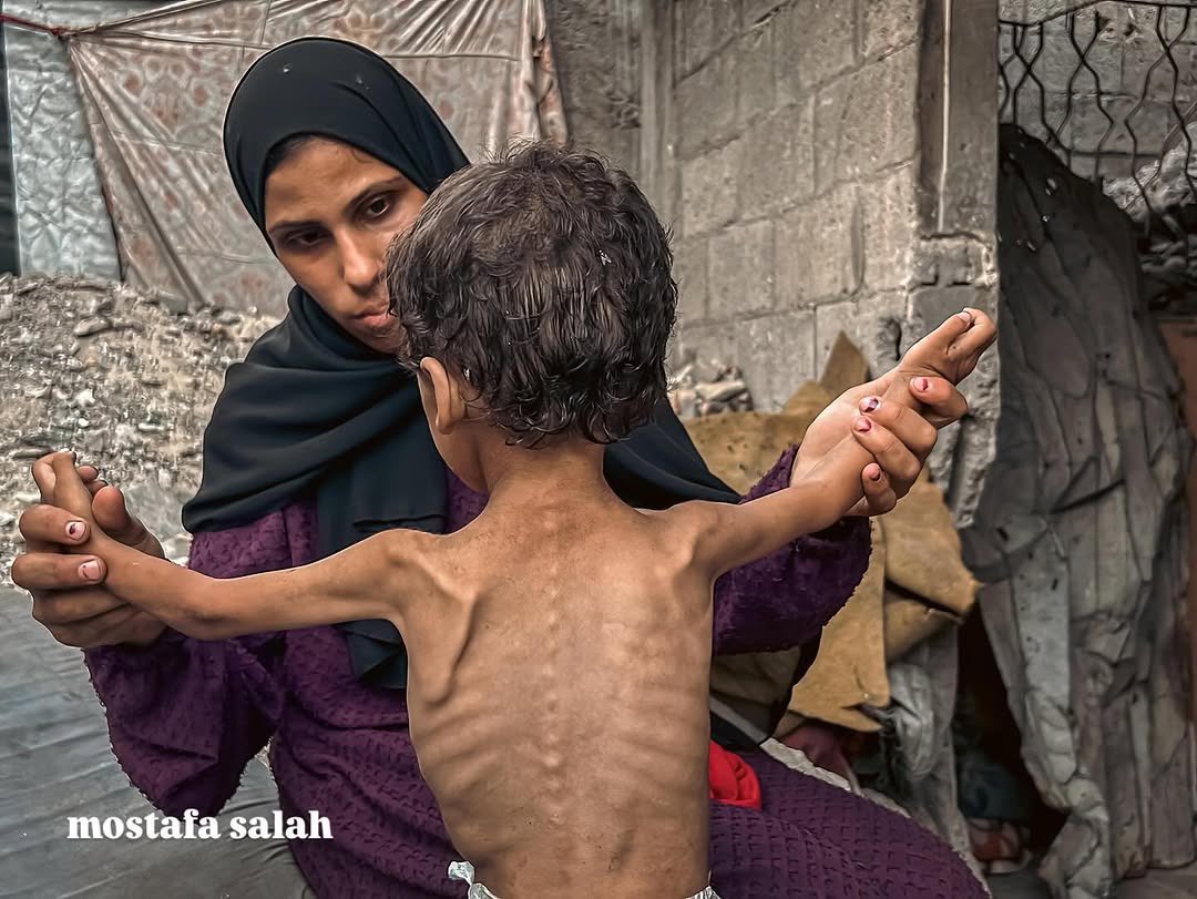 Nermeenalswaisi's tweet photo. Gaza is starving. 

Are you still with us ? Do you hear us !
Reply with 🇵🇸 if you see this pic, pass it ... 💔 https://t.co/YadlDjqRSI