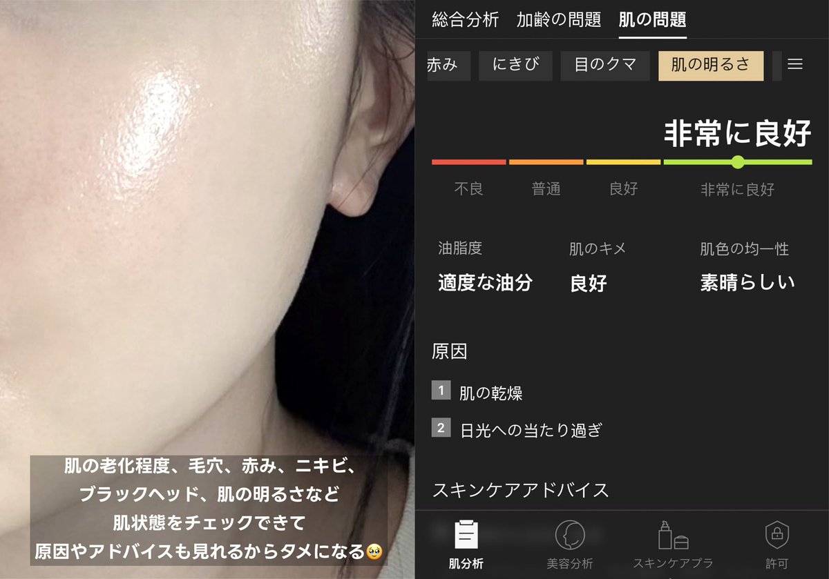 suni__fit's tweet image. 韓国での肌管理で新規開拓した
『Seyeクリニック』が良すぎた件🏥
推しポイントは高性能の肌診断で自分の肌状態を事細かにチェックできる&本当に必要な施術が分かること ! !
その他にも⤵︎
・新論峴駅7番出口近くで立地神
・日本人室長常駐
・タックスリファンドの機械有
・日曜祝日も診察OK…