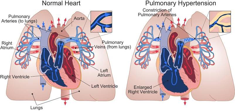 🧵 Cardiac Signs in Rheumatology – Don’t Miss These!

Rheumatic diseases often whisper through the heart before they shout elsewhere.
Here are 10 cardiac clues you should always check for 👇

#RheumTwitter #MedTwitter #Cardiology #InternalMedicine #Rheumatology <a href="/IhabFathiSulima/">Dr Ihab Suliman</a>