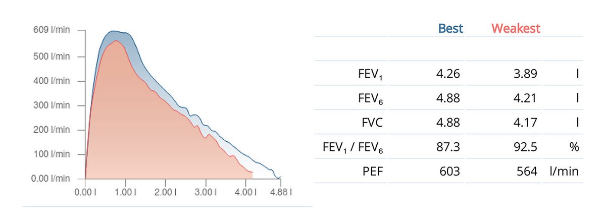 1/2 🧵
When was the last time you measured your lung function with a spirometer? A spirometer is a medical device used to assess lung function, and it can be employed in studies related to air pollution to evaluate the impact of pollutants on respiratory health.