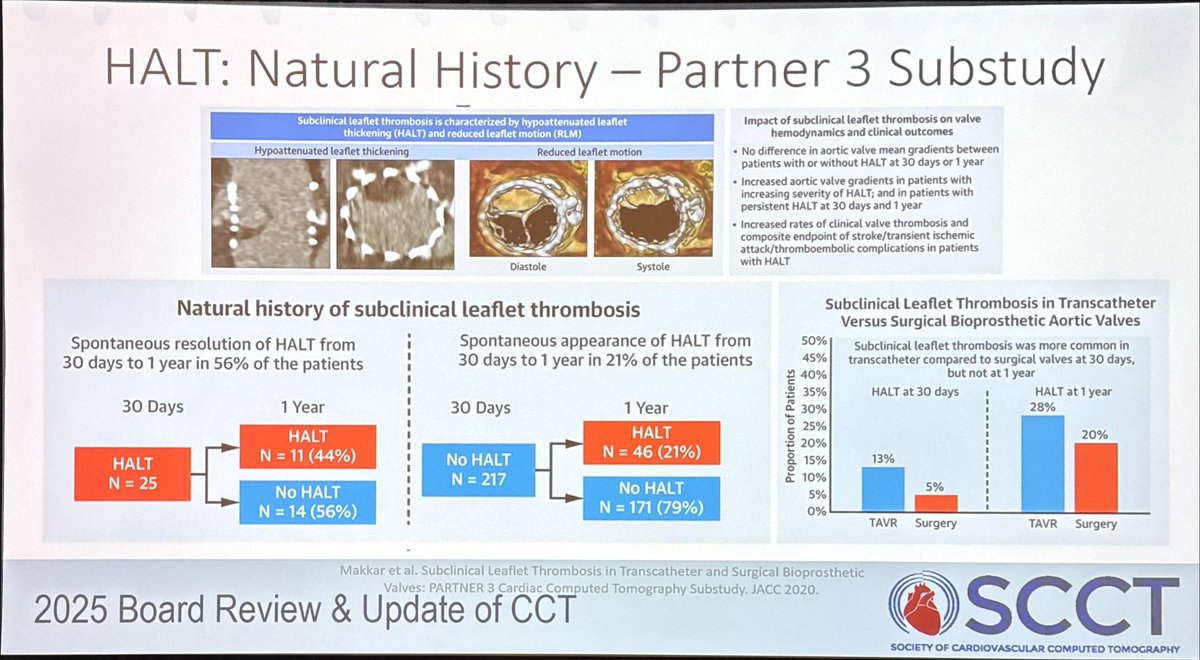 Sagit Ben Zekry (@sagitben) on Twitter photo James Lee discussed prosthetic Valve dysfunction following TAVR: HALT
<a href="/Heart_SCCT/">Heart_SCCT</a> #SCCT2025 #YesCCT James Lee discussed prosthetic Valve dysfunction following TAVR: HALT
<a href="/Heart_SCCT/">Heart_SCCT</a> #SCCT2025 #YesCCT