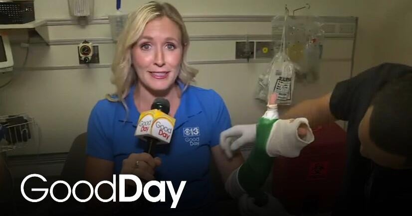 shrinershosp's tweet image. Summer is the time for kids to play all day, but that often means accidents happen. @GoodDaySac was at @shrinersnorca with tips for what to do if your child gets hurt: ow.ly/I5Bj50WpRCk #InjuryCare #parents #SummerSafety