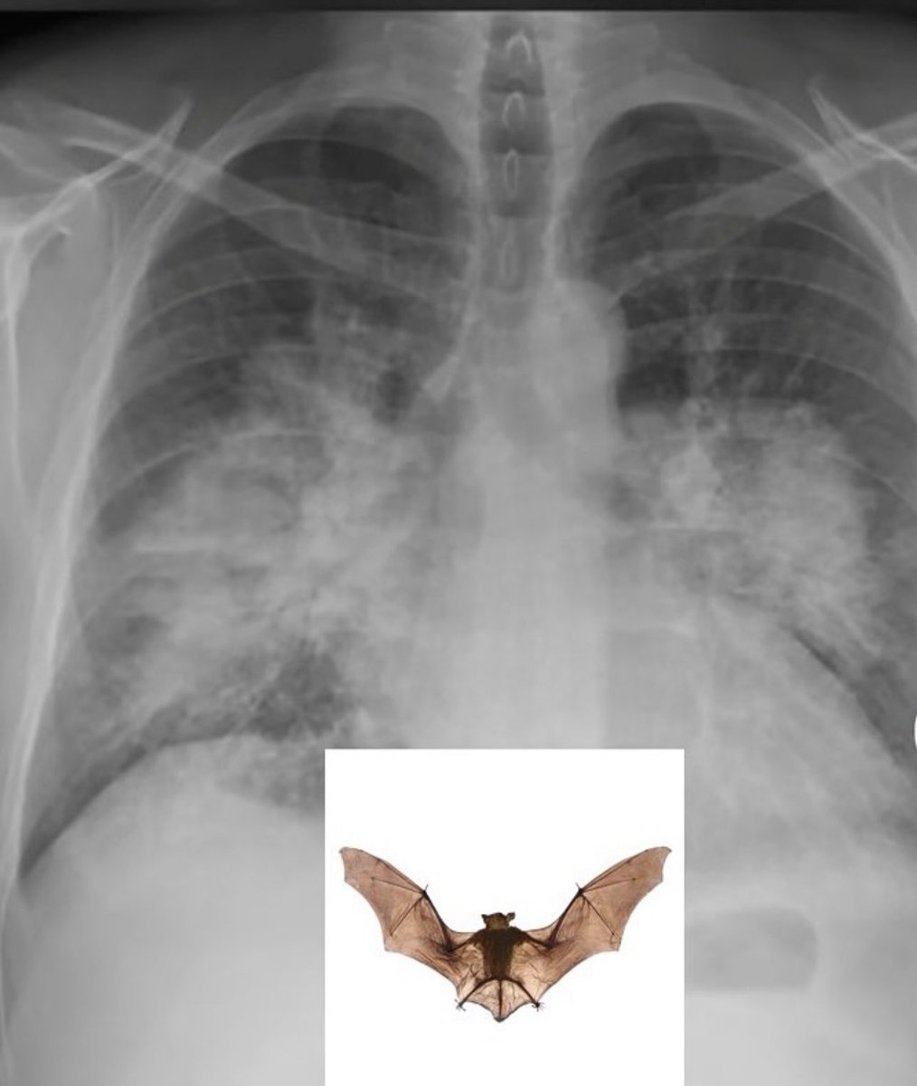 Oren Gottfried, MD tweet media