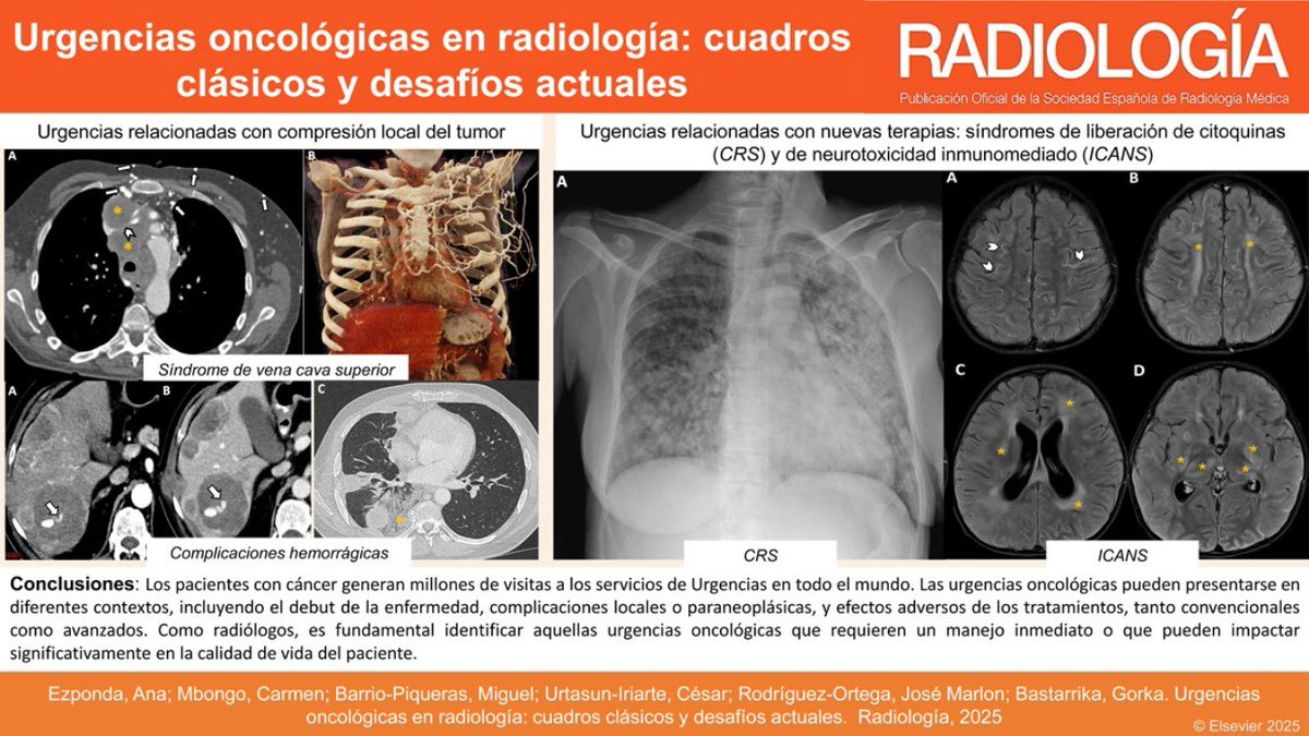 César Urtasun (@cesurtasun) on Twitter photo 🚀Hot off the press 📄 Orgulloso de trabajar con este equipazo. Especial agradecimiento a <a href="/AnaEzponda/">Ana Ezponda</a> ⚡️ Gran trabajo!
doi.org/10.1016/j.rx.2… 🚀Hot off the press 📄 Orgulloso de trabajar con este equipazo. Especial agradecimiento a <a href="/AnaEzponda/">Ana Ezponda</a> ⚡️ Gran trabajo!
doi.org/10.1016/j.rx.2…