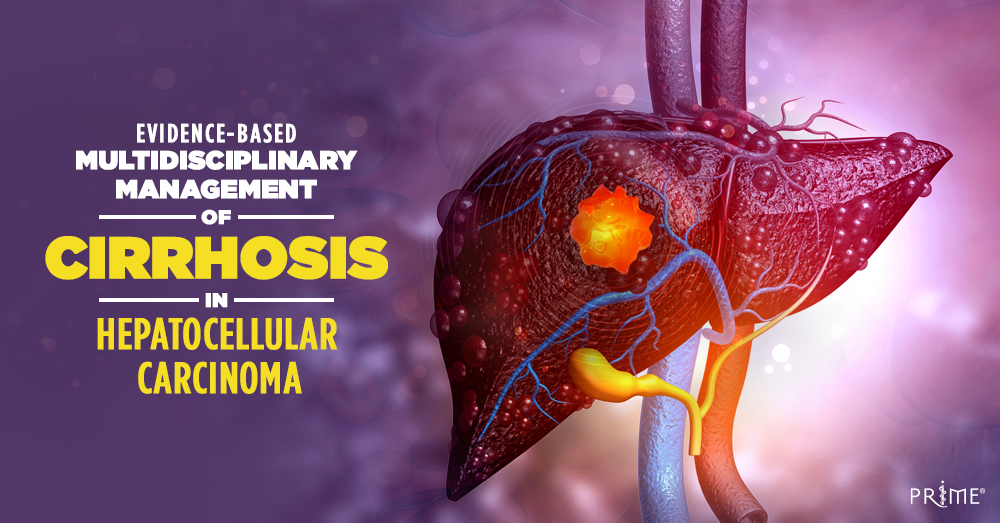 PRIME_cme's tweet image. HCC: Tools for cirrhotic variceal evaluation and management | Evidence-Based Multidisciplinary Management of Cirrhosis in Hepatocellular Carcinoma | 0.5-hour CME/CE | Enduring Webcast | #MedEd #cme #CirrhosisManagement #HepatocellularCarcinoma | bit.ly/4eIPfgF