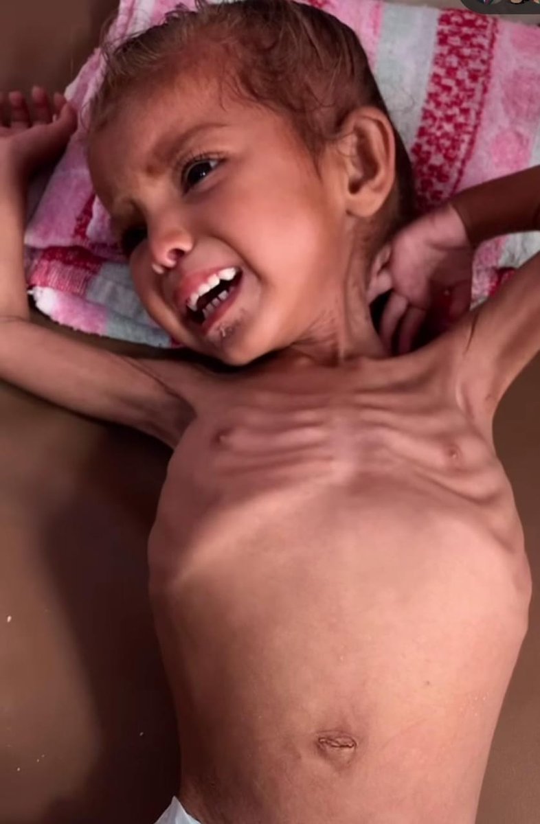 Perfectm112's tweet photo. #Feed_Gaza_Now
⚠️⚠️📢⚠️⚠️ HUMANITY IN DANGER
International Humanitarian Law ( Geneva Conventions )
Article 54(1):
"Starvation of civilians as a method of warfare is prohibited."
LET'S SAY IT OUT LOUD !!! 🔊 ISRAEL COMMITTING A WAR CRIME ⚠️
#SAVE_HUMANITY
#Feed_Gaza_Now https://t.co/oqcm4p1LbT