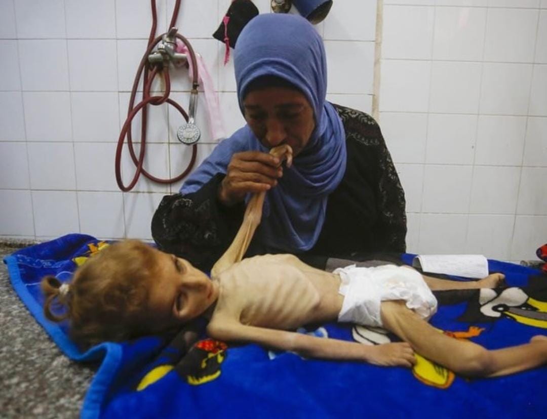 Perfectm112's tweet photo. #Feed_Gaza_Now
⚠️⚠️📢⚠️⚠️ HUMANITY IN DANGER
International Humanitarian Law ( Geneva Conventions )
Article 54(1):
"Starvation of civilians as a method of warfare is prohibited."
LET'S SAY IT OUT LOUD !!! 🔊 ISRAEL COMMITTING A WAR CRIME ⚠️
#SAVE_HUMANITY
#Feed_Gaza_Now https://t.co/oqcm4p1LbT