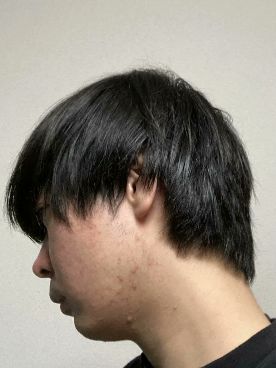 𝐴𝑘𝑖｜垢抜けアンチエイジング tweet media