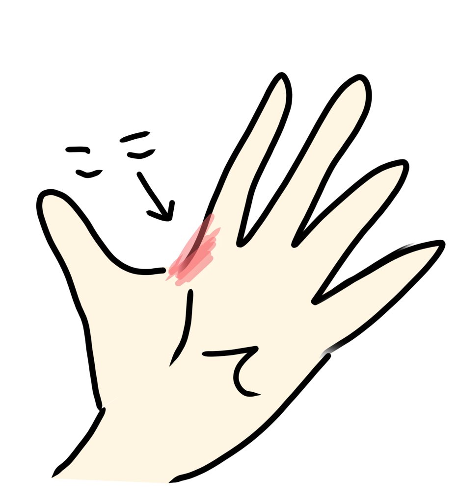 oyasmi__zzzz's tweet image. 手を虫に刺されました。これが何を意味するかお分かりでしょうか？そうです、ペンを持つのが辛いです笑
ペンを持つと丁度当たるのです。だからといってお絵かき欲はなくならないのが恐ろしいですね。
