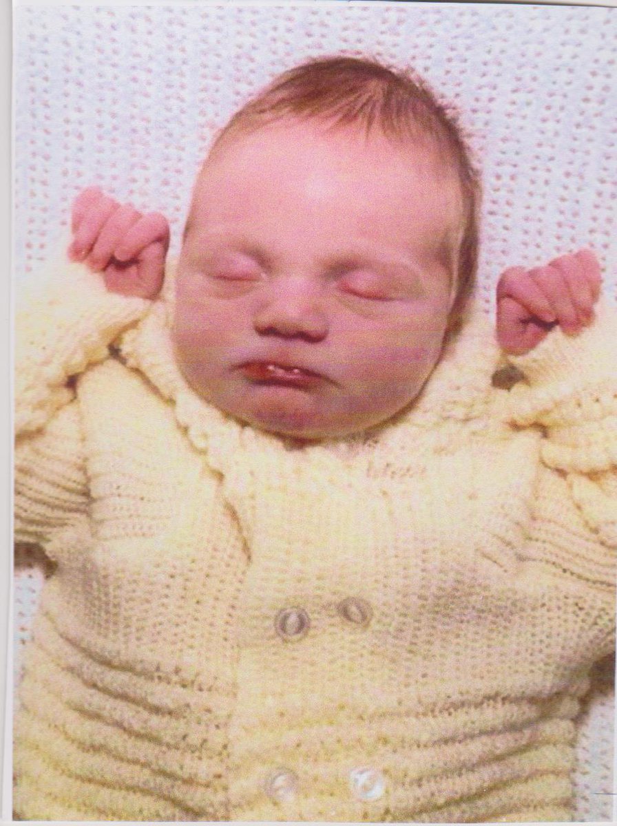 JanetWilliams99's tweet image. We @Infactuk @Emma4facs have approx 2000 people, of all ages affected by Valproate in pregnancy on database. 2000 with avoidable harm! Yet it's 18 months since #HughesReport 5 yrs since #CumberlegeReview and this Govt continues to make them wait in limbo & suffer in silence.
