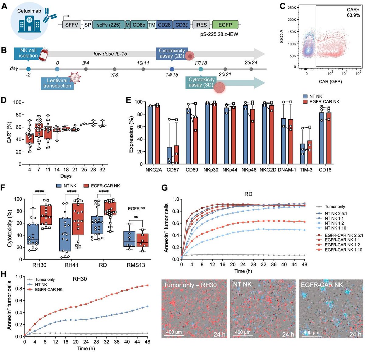 PatrickHwuMD's tweet image. #ScienceSaturday
🧬 Can we improve #immunotherapy for hard-to-treat pediatric cancers like rhabdomyosarcoma?
➡️ A new study in the Journal for ImmunoTherapy of Cancer explored combining EGFR-targeted CAR natural killer (NK) cells with radiotherapy to treat rhabdomyosarcoma, the…