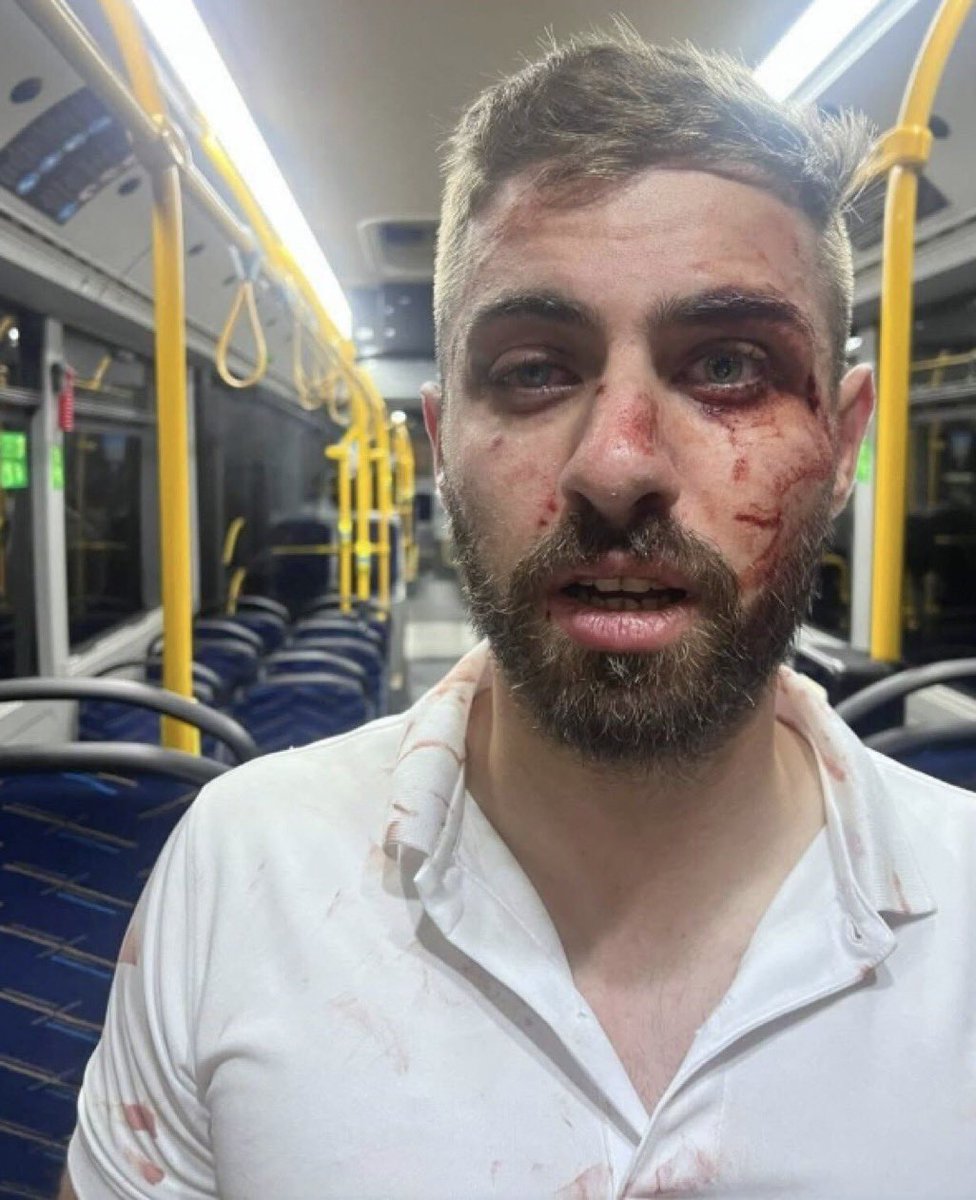 Yossi_eli's tweet image. זוכרים את נהג האוטובוס שהותקף בנווה יעקב רק כי הוא ערבי? אז משטרת ירושלים באמת לקחה ברצינות את האירוע, עצרו את החשוד המרכזי, הביאו אותו לחקירה, אפילו הצליחו להגיע למצב שהפרקליטות מגישה הצהרת תובע. אממה, האיש מובא להארכת מעצר נוספת. מבחינת המשטרה היה צריך להיות עסק סגור: הארכת…