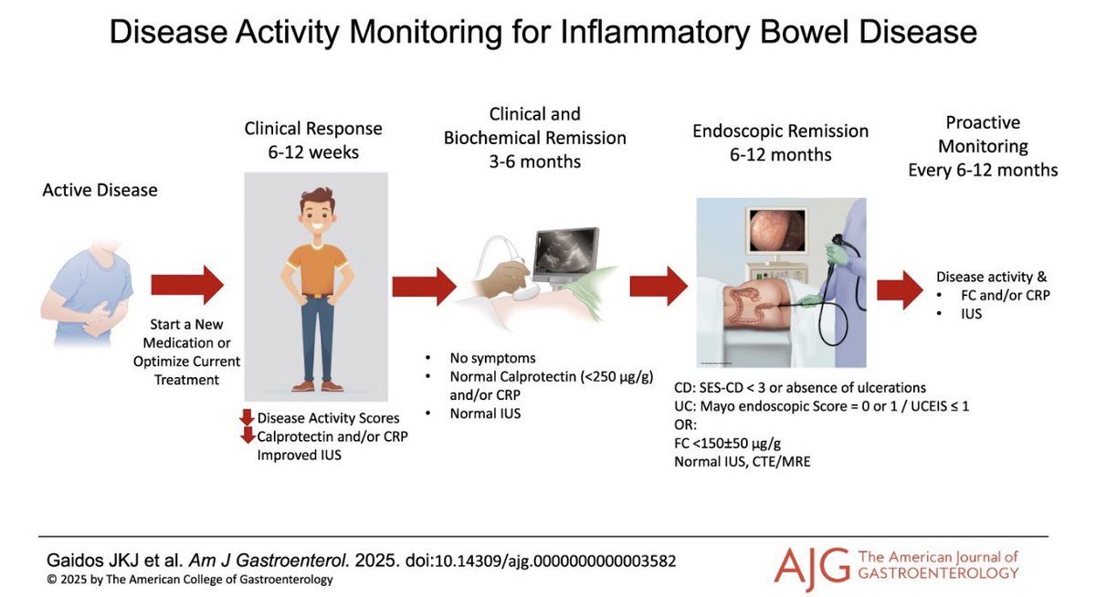 JHashashMD's tweet image. Check out practical advice 📝 on
Monitoring Inflammatory Bowel Disease Activity: When, How, and Why
In @AmCollegeGastro @AmJGastro with @JillGaidosMD
✅ for:
🚽🩸Clinical response and remission
🧪💩💉Biochemical
🧐🔎🔬Endoscopic
🩻 Radiographic
pubmed.ncbi.nlm.nih.gov/40488637/