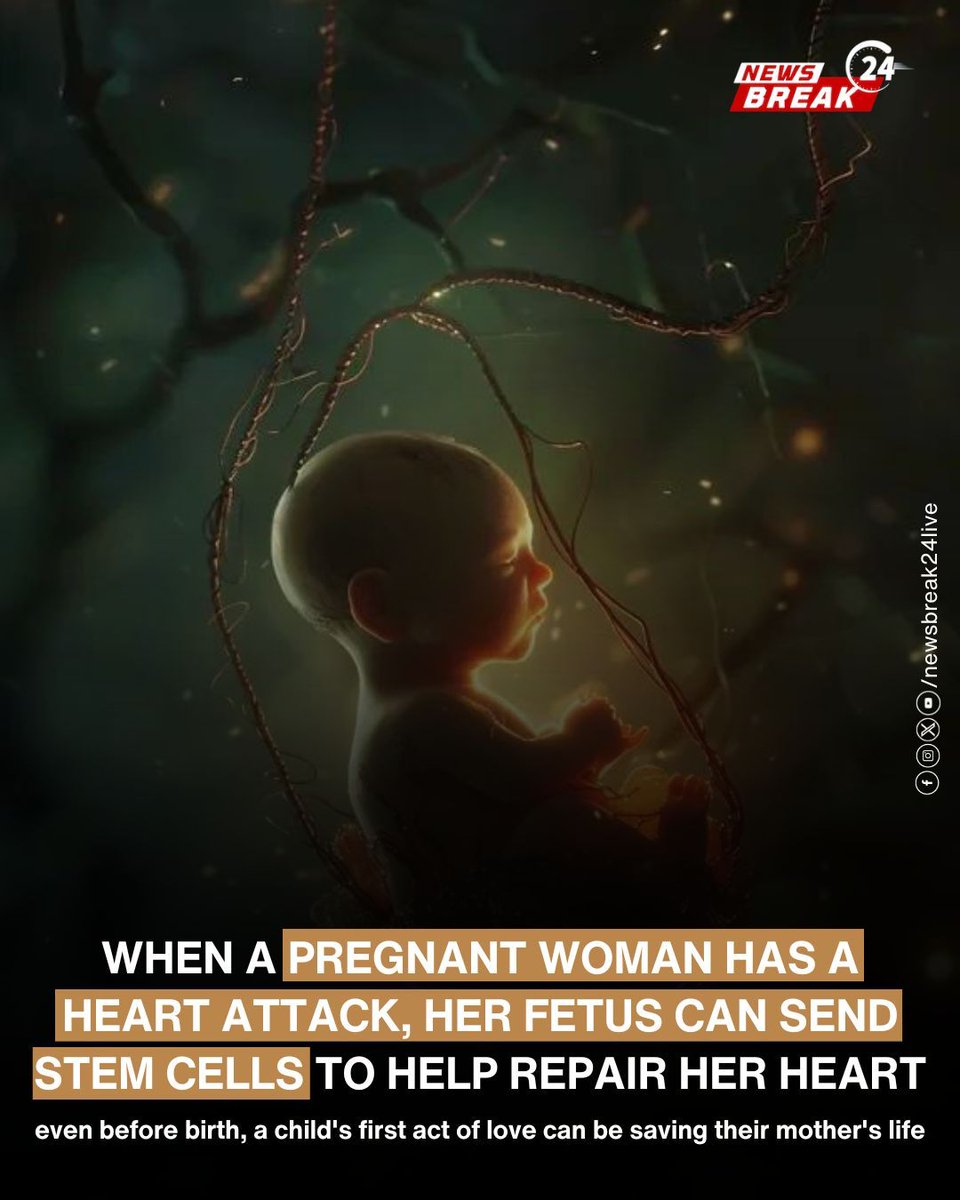 NewsBreak24Live's tweet image. A groundbreaking study has revealed that when a pregnant woman suffers a heart attack, her fetus might play an unexpected role in her recovery.
.
#MedicalBreakthrough #PregnancyScience #HeartAttackRecovery #FetalStemCells #RegenerativeMedicine #PlacentalStemCells #MaternalHealth