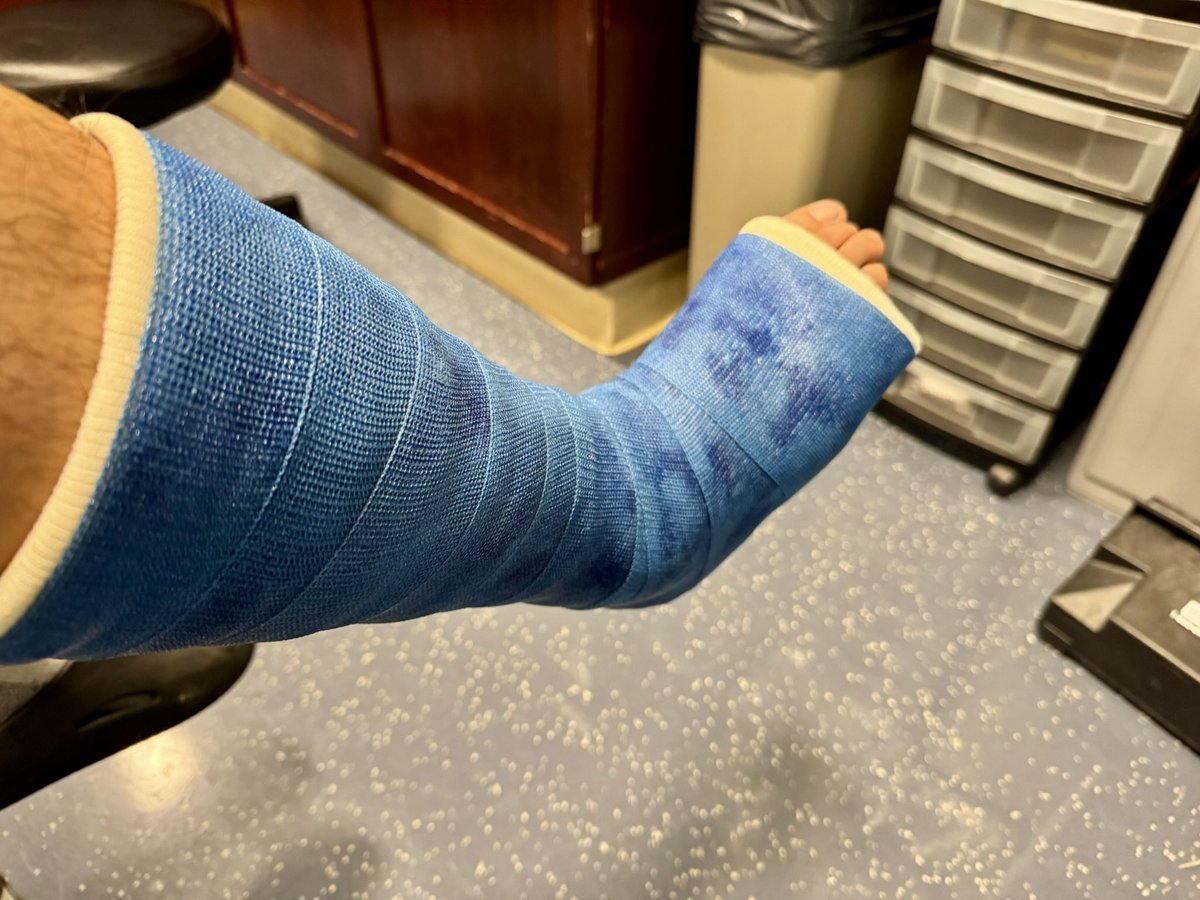 kchang's tweet image. It’s hard to believe this was my ankle only 3 months ago. But I am recovering well ahead of schedule and am confident I will conquer the @PanMass in 2 weeks!
I am only 60% of the way towards my goal so if you haven’t contributed yet, please help out!
🙏
profile.pmc.org/KC0466