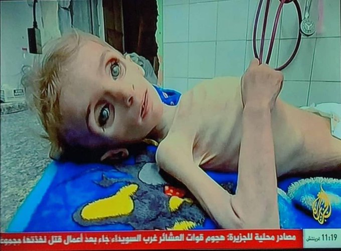 اللهمَّ إنّ الأرض قد ضاقتْ،
وامتلأتْ بأنين المقهورين المظلومين
ولا ناصر لهم إلا أنت!
فبقدرتك التي لا تُغلب،
وبجبروتك الذي لا يُرد،
أرنا في الصهاينة الطغاة المجرمين بأسك الذي لا يُصد ولا يُرد، ولا يقدر على دفعه أحد"
#غزه_تموت_جوعاً #غزة_الفاضحة