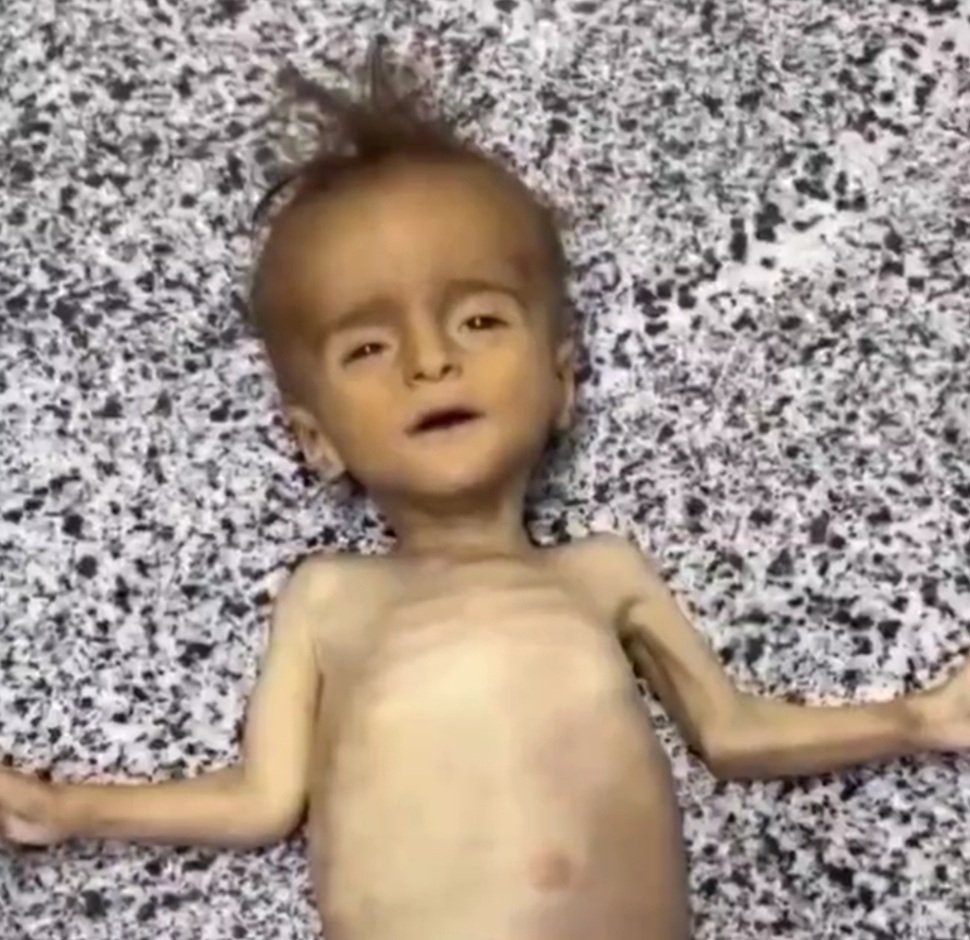 Bonyanon_Marsus's tweet image. کاری که با مردم غزه کردند: قتل صبر
یعنی در پیش چشم مردم کسی را حبس کنند و بدون اینکه بتواند از خود دفاع کند و یا خود را نجات دهد،او را آنقدر شکنجه کنند تا بمیرد بمباران،بیماری،گرسنگی،تشنگی
کاری که با مردم دنیا کردند: عادت دادن به تماشای نابودی انسانها
#غزة_تُباد
#غزه_تموت_جوعاً