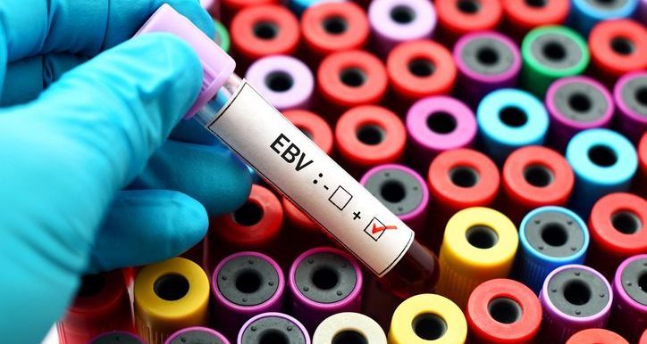 Pierre Fabre Pharmaceuticals announced development updates for tabelecleucel for EBV+ PTLD, including a transfer of the Investigational New Drug Application and resubmission of the Biologics License Application.

➡️ buff.ly/duqnFKU