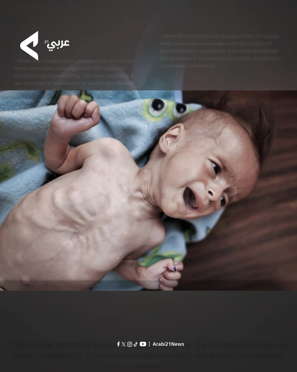 Arabi21News's tweet photo. 📸أطفال غـ ـزة في مواجهة مجاعة صامتة..
صور مؤلمة من العيادات المحلية تكشف ضعف الأطفال وفقر التغذية داخل القطاع المحاصر.

#عربي21 https://t.co/lXnhRTnkLc