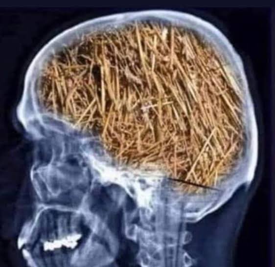 İmamhatipleri fotoğraflta ki zihniyet asla kabul etmedi. İsteseniz de istemeseniz de buralardan çıkan her öğrenci memleketin hayrına Hava da Karada Denizde mazlum ve mağdurun olduğu her yerde insanlığın selameti ve huzurunu sağlayacak inançta ve azimdedir Elhamdulillah.🇹🇷👆