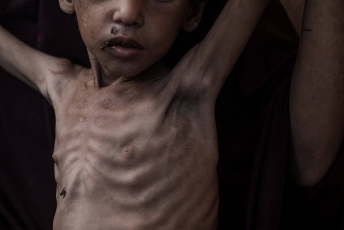 RamAbdu's tweet photo. Israeli starvation and global silence are consuming Gaza’s children, women, and men. https://t.co/XPP7hUEOjd