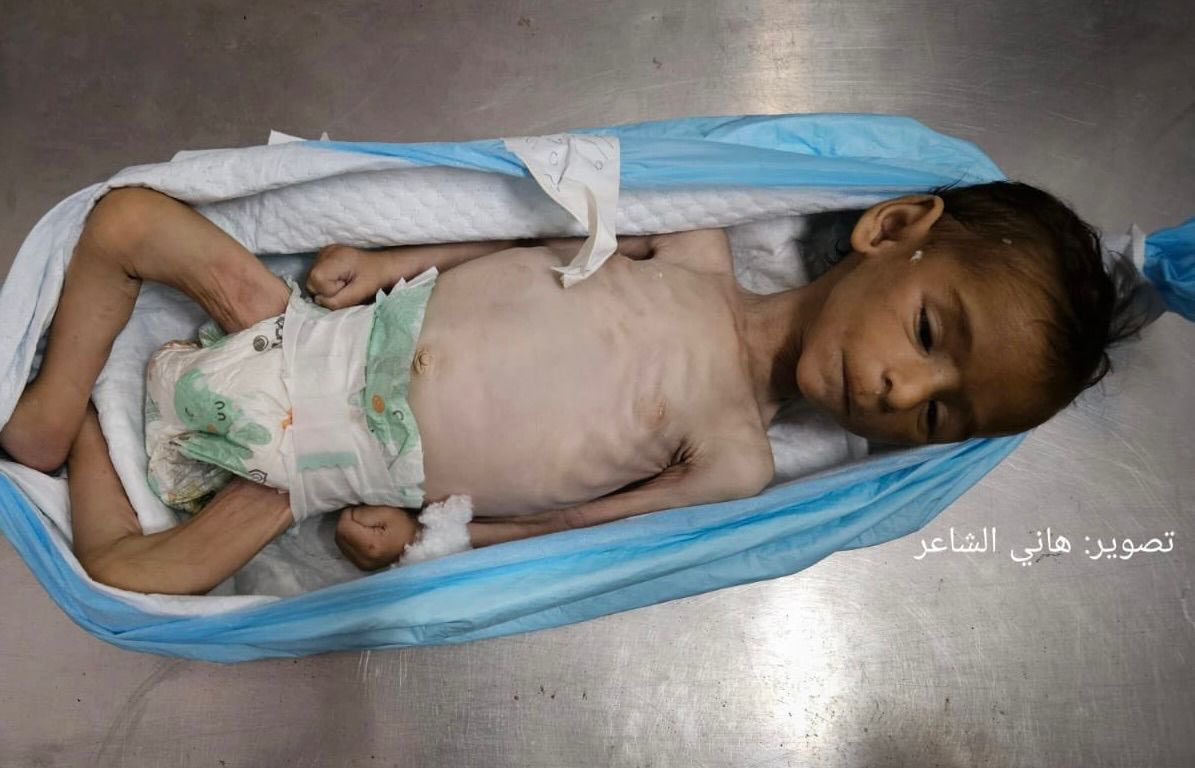 nahed_hajjaj99's tweet image. This is Yahya Al-Najjar. He died today because food is being blocked.
I’m glad he no longer has to endure this shameful world.
If this blockade continues, this will be the fate of all of us and our children, lifeless bodies that you grieve for one day, then forget the next.