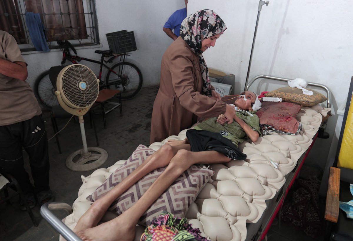 Palestinian Ministry of Health – Gaza:

“Unprecedented numbers of starving citizens of all ages are reaching emergency departments in a state of severe exhaustion and fatigue. We warn that hundreds whose bodies have wasted away are at imminent risk of death due to hunger, having