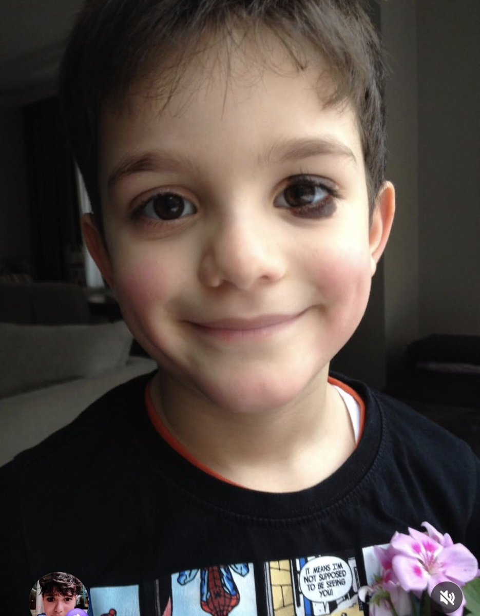 Hic bir suçu gunahi yokken öyle bir kötülükle katledildi  ki hepimizin bogazi düğüm ama 6 Aydır adaleti sağlanamadı..Utanıyorum.#AdaletCaydırıcıOlsun #MattiaAhmetMinguzzi