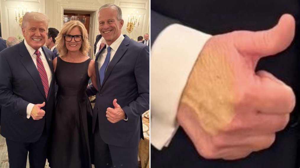 Hey MAGA, didn't the Christian Bible say the "mark of the beast" would be on the right hand or forehead? 🤔