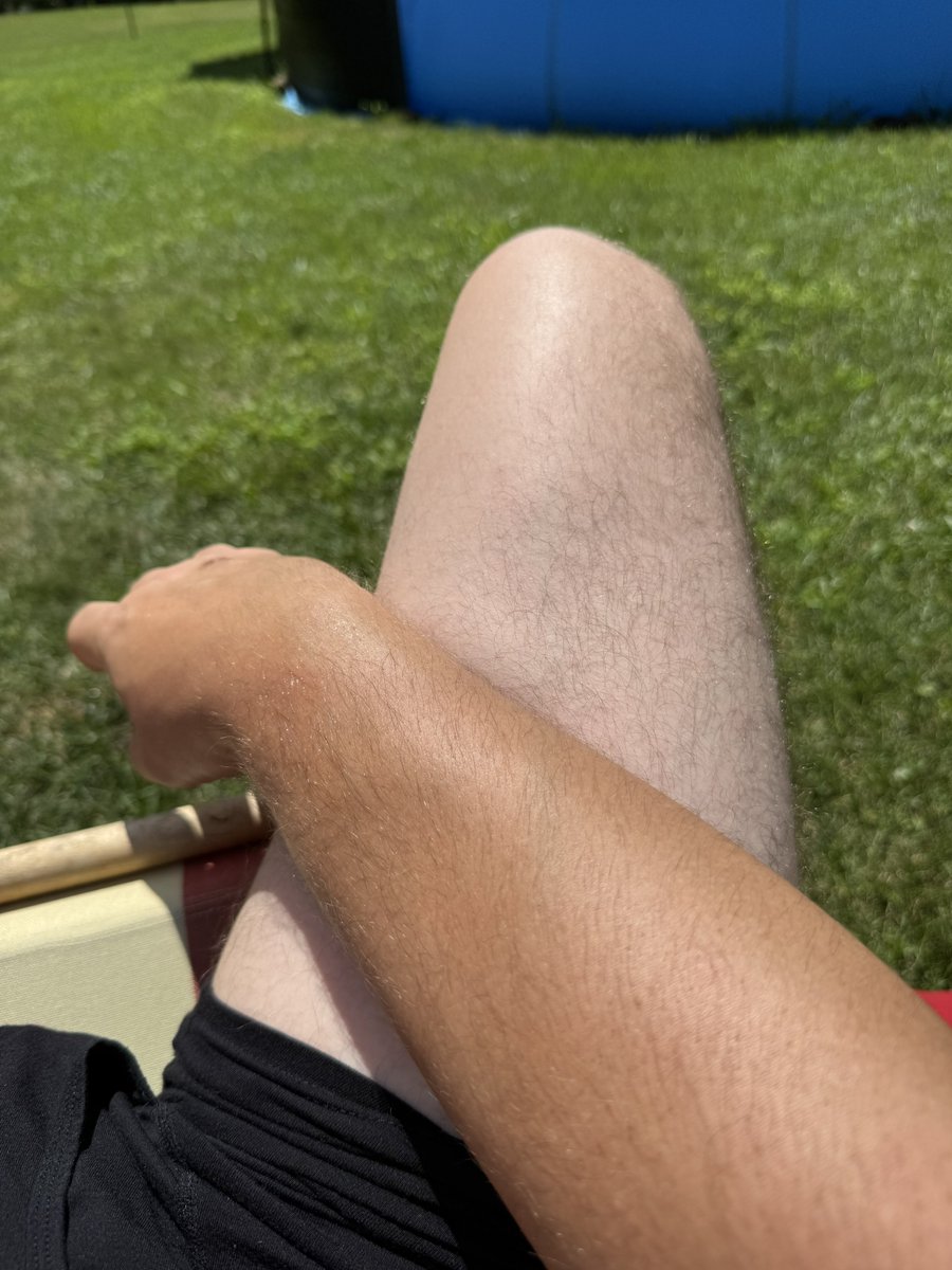 CvatikPhoto's tweet image. how does one fight this issue when working outside all summer?