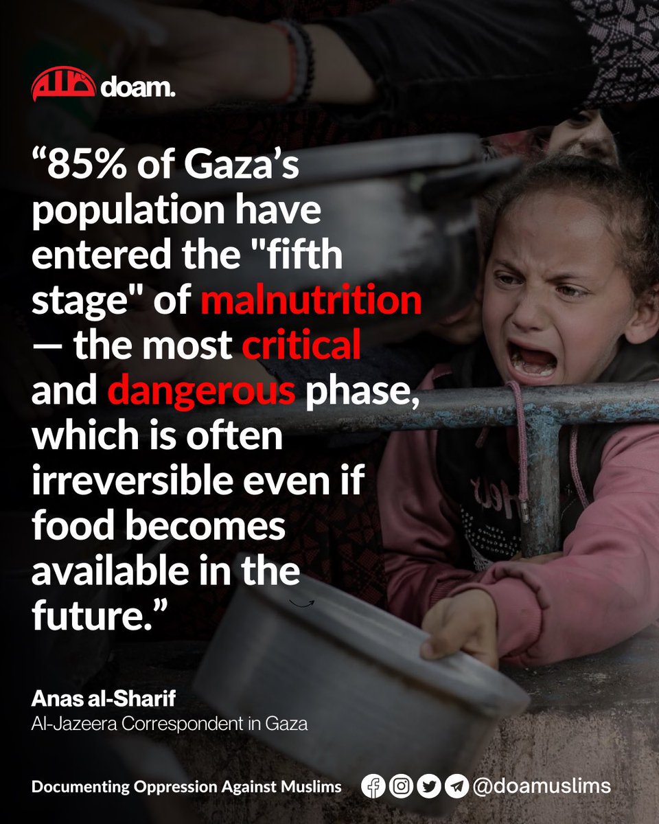 Siz açlığı öyle insanın birkaç gün, birkaç hafta dişini sıkabileceği bir şey mi zannediyorsunuz? Hele de çocukların?

Açlık vücuda diğer tüm rahatsızlıklardan daha fazla acı ve zarar verir. En acılı ölüm şekildir açlıktan ölmek.

Gazze’deki insanların %85’i şu anda açlığın öyle
