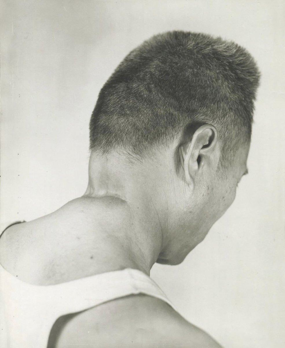 bankolewya's tweet image. A filipino survivor of the Manila massacre, shows where a Japanese officer tried to behead him