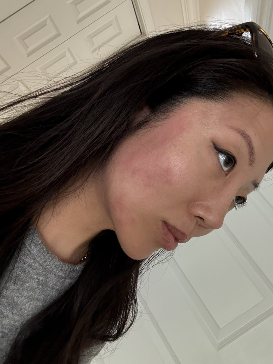 TiffanyxFong's tweet image. i am having an allergic reaction to my sister鈥檚 dog 馃槴