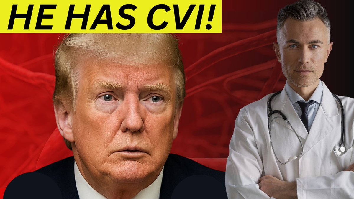 BiohackingIT's tweet image. WATCH NOW: youtu.be/qHe9ixQJOUk
#ChronicVenousInsufficiency #CVI #TrumpHealth #DonaldTrumpDiagnosis #VeinHealth #LegSwelling #HeavyLegs #PoorCirculation #VenousDisorder #VascularHealth #LegFatigue #CompressionSocks #LegPain #SwollenAnkles #SockMarks #BloodFlowIssues…