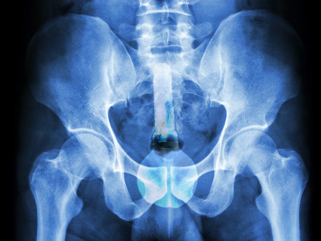 Hydroxate's tweet image. We know where that @PlayWarframe stick is going tonight, watch out local ER #tennocon2025