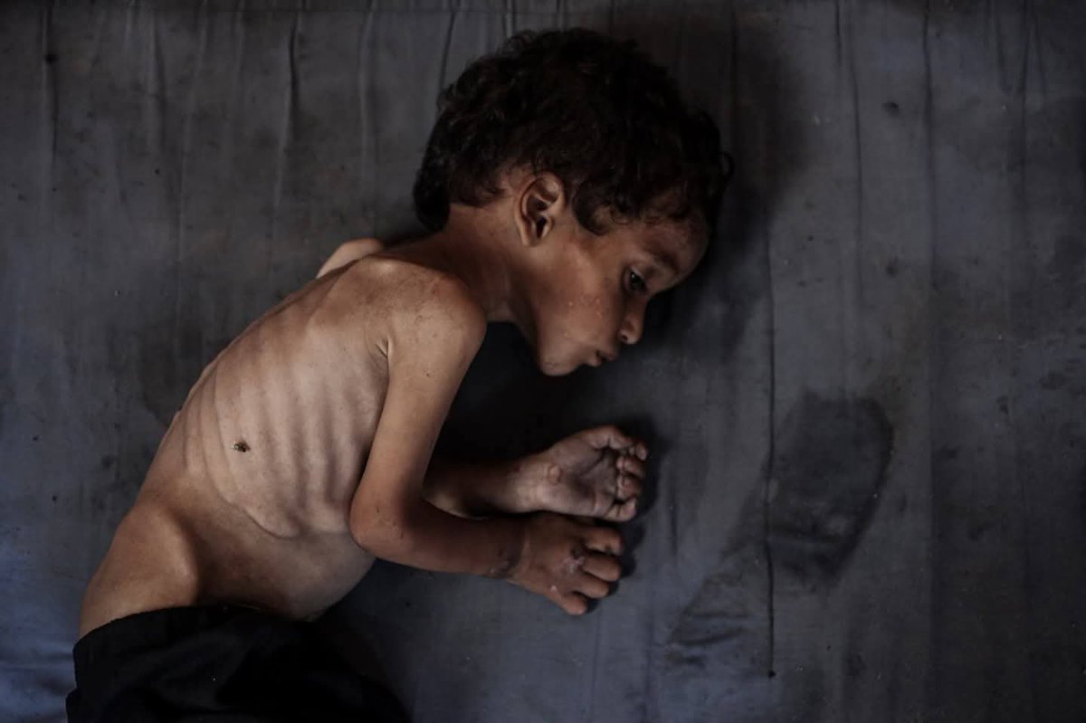 omarsuleiman's tweet image. Let it be clear, anyone that defends Israel’s genocide in Gaza, or is even silent on it, is not worth being around or engaging ever again.
Never let these people, politicians or otherwise, pose as your allies on anything again.
Starving children to death is irredeemably evil.