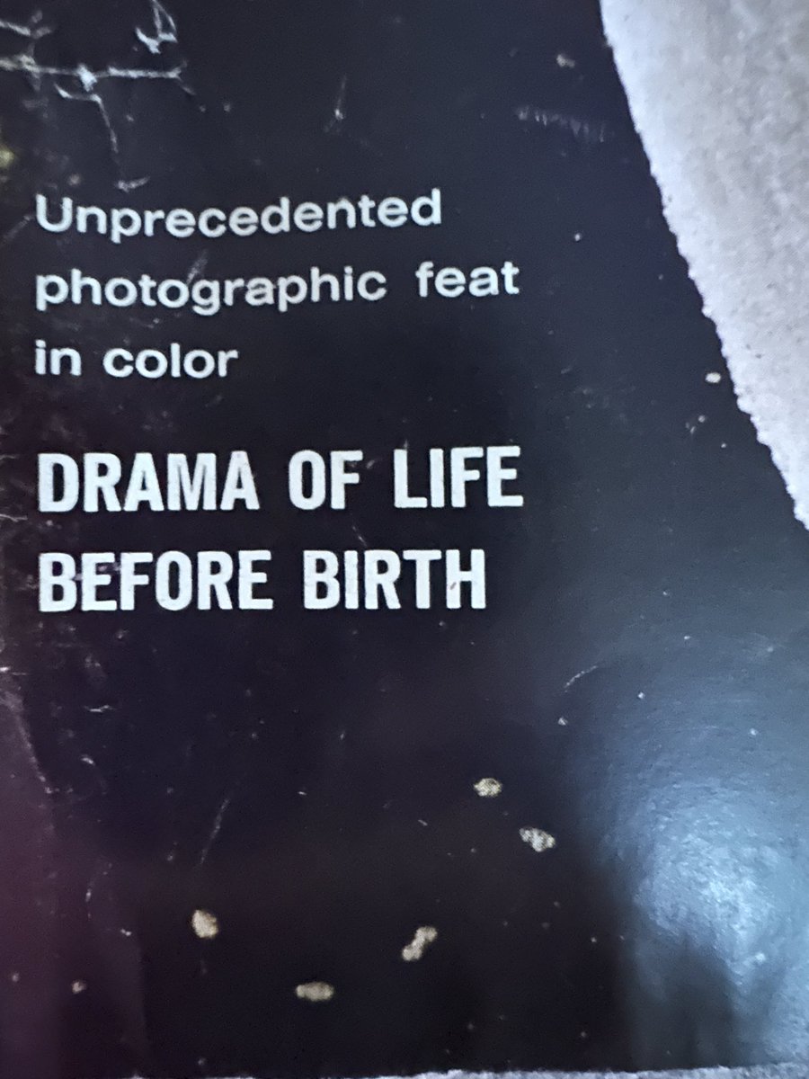 clickforohio's tweet image. Have you ever seen this iconic edition of @LIFE? These were groundbreaking photos for this day and age. For context, this child was about the same age as me. Published the on April 30, 1965, I was born in December of the same year. This was before the misguided Roe v. wade…