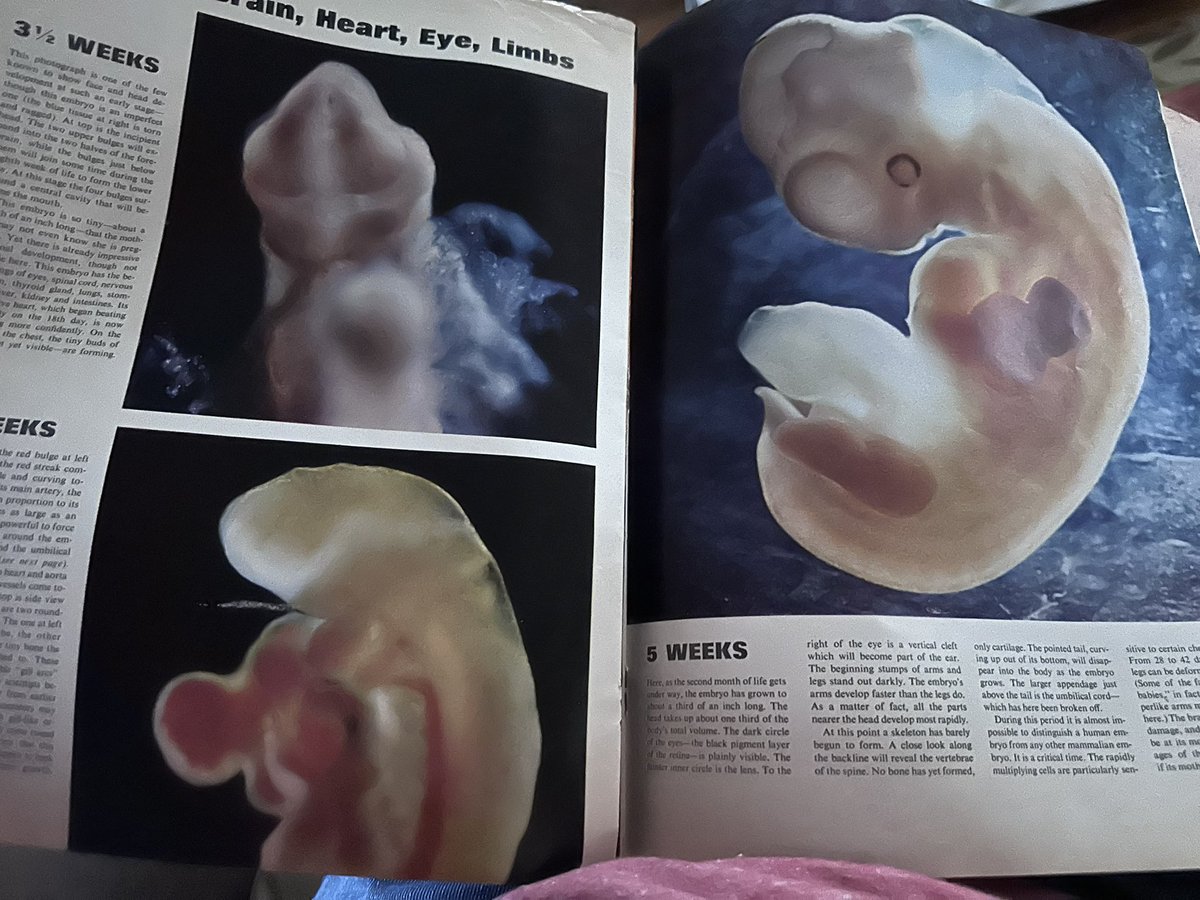 clickforohio's tweet image. Have you ever seen this iconic edition of @LIFE? These were groundbreaking photos for this day and age. For context, this child was about the same age as me. Published the on April 30, 1965, I was born in December of the same year. This was before the misguided Roe v. wade…