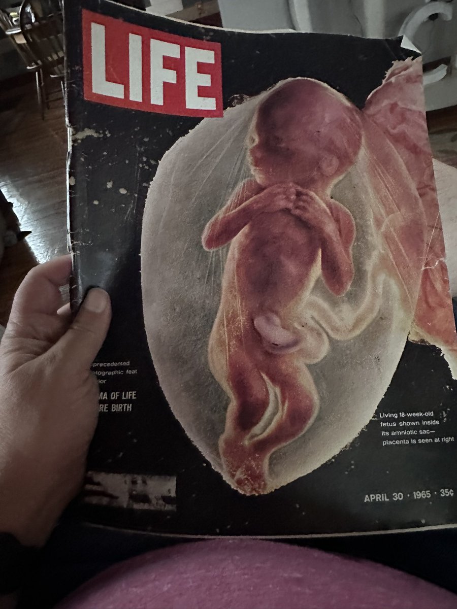 clickforohio's tweet image. Have you ever seen this iconic edition of @LIFE? These were groundbreaking photos for this day and age. For context, this child was about the same age as me. Published the on April 30, 1965, I was born in December of the same year. This was before the misguided Roe v. wade…