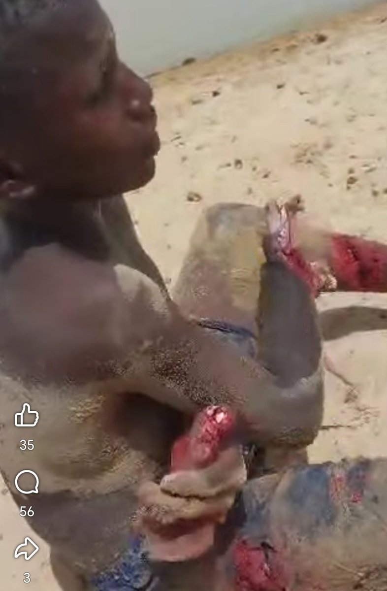 Ag_Outalabit's tweet photo. 🔴 Massacres silencieuses à l’Azawad :
L’armée malienne et les mercenaires russes posent des mines sur les routes et dans les champs, faisant des victimes parmi les civils, bergers et enfants.
Une arme lâche qui tue même après leur retrait !
#Azawad #CrimesDeGuerre #Mali #Wagner https://t.co/tGaJPAOC1f