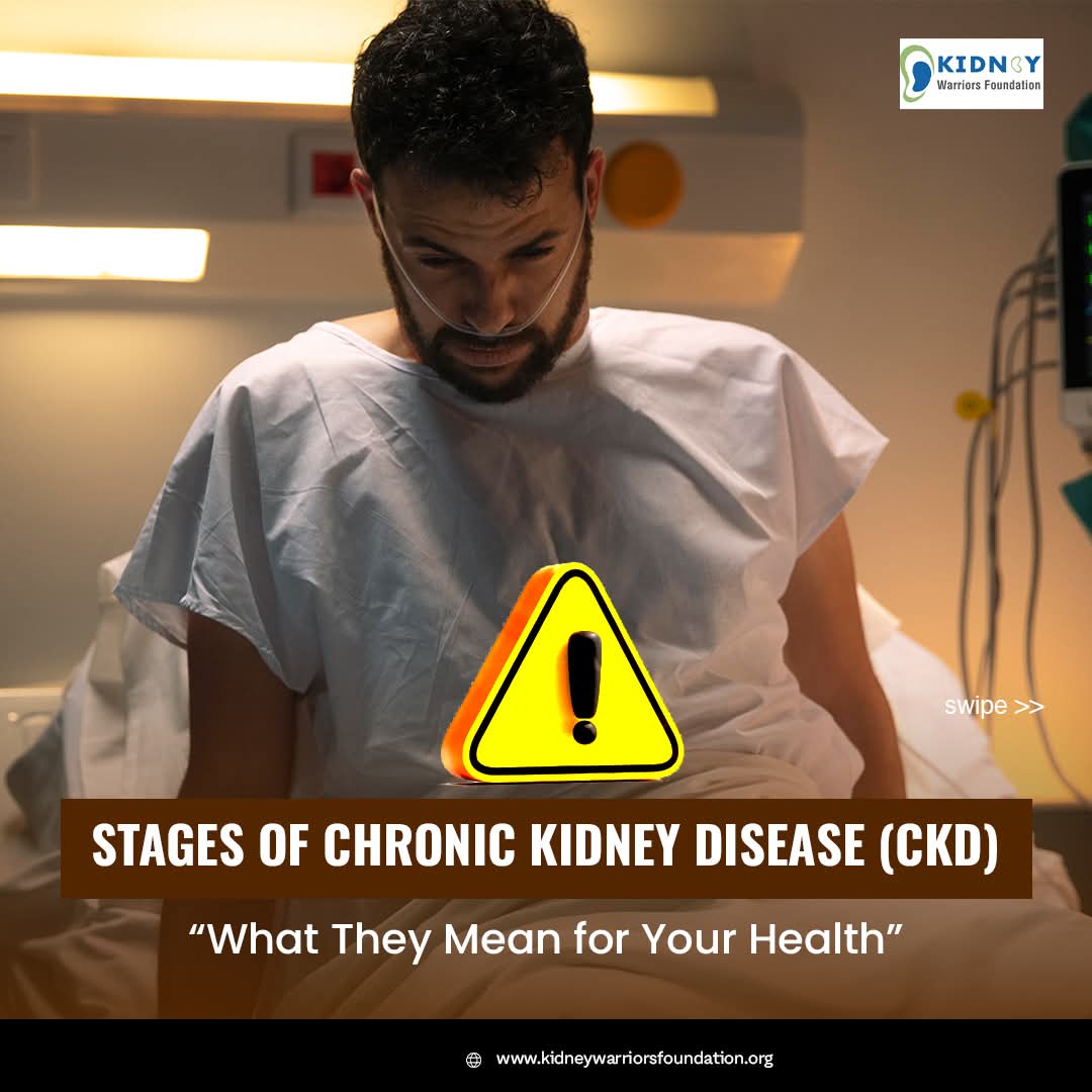 🚨 Stages of Chronic Kidney Disease (CKD) – What They Mean for Your Health 

Your kidneys work hard to keep your body healthy, but chronic kidney disease (CKD) can silently damage them over time. Understanding the 5 stages of CKD can help with early detection.