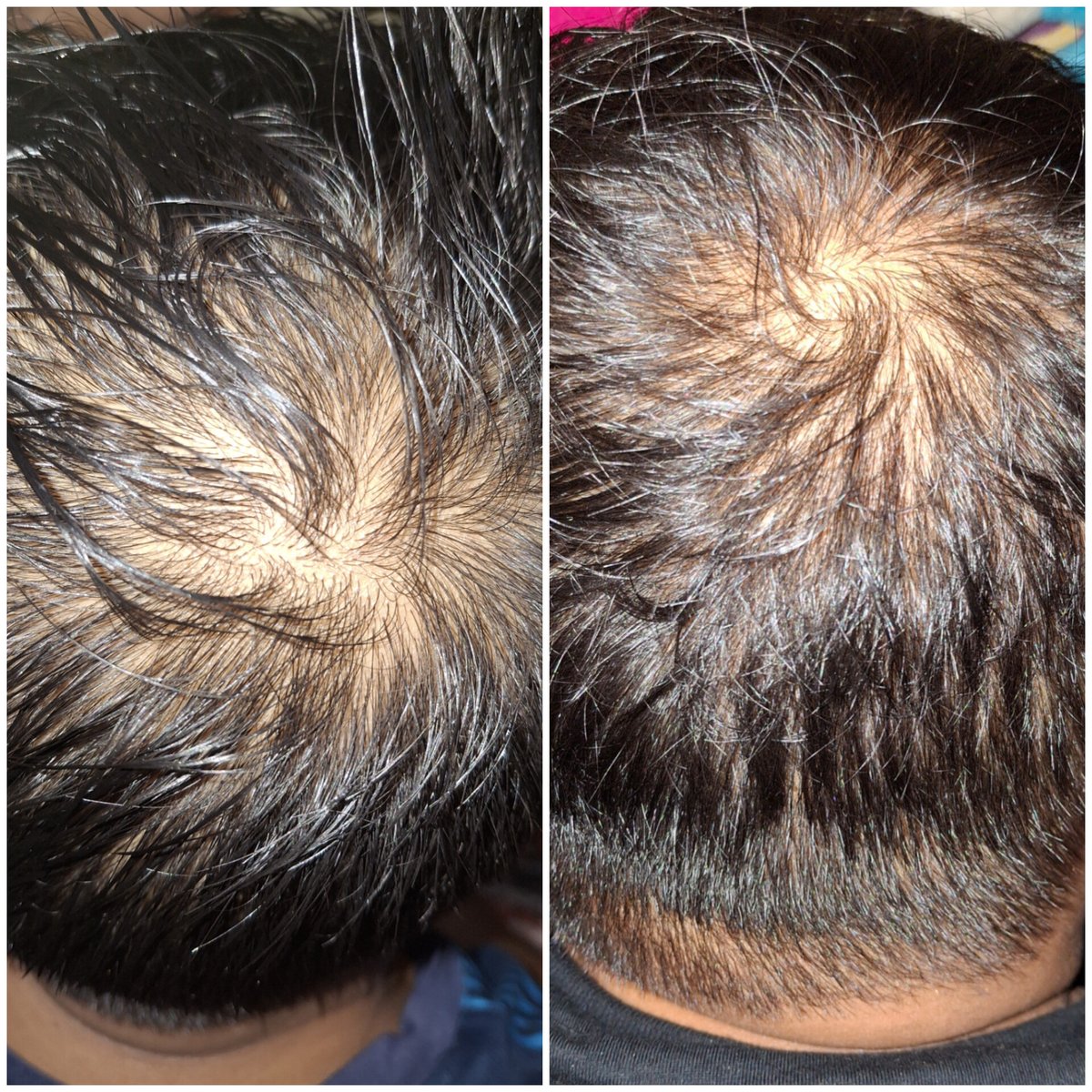 chocobubub's tweet photo. Hair tonic recommended by Dr. Tirta and I don't regret buying it https://t.co/7f6TrCu61c