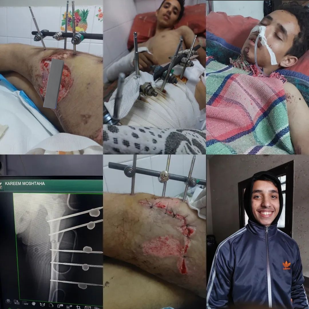 Tamer_Moshtaha's tweet photo. 1364/2000€🎯
Please, my brother Karim @TMoshtaha14465, I need you to support his account.
Don't make hope more difficult 
Follow him and share his tweet 
Donate what you can 
Share and follow, you can do it 
come on guys 
📍https://t.co/XoFI1sI9Xz https://t.co/tmeZ2zKRLm