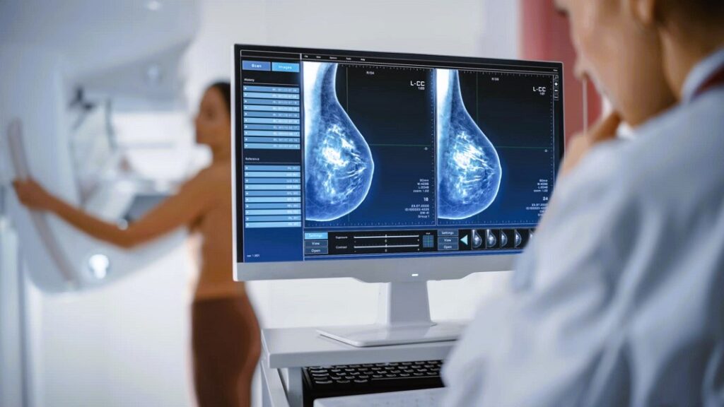 BREAKING NEWS: SWITZERLAND BECOMES THE FIRST COUNTRY TO BAN MAMMOGRAPHY! A GLOBAL MEDICAL SCANDAL EXPOSED!

Breaking news: Switzerland becomes the first country to BAN mammography, exposing the shocking truth behind the medical industry’s biggest scam. Discover how mammograms